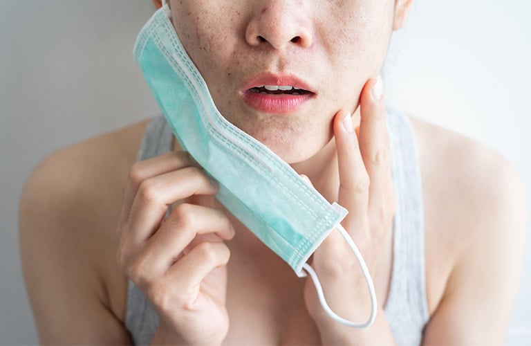 最近多い″マスクネ″対策