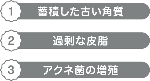 １ 蓄積した古い角質 ２ 過剰な資質 ３ アクネ菌の増殖